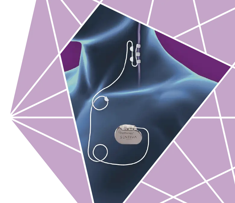 vns generator and lead implanted during vns surgery